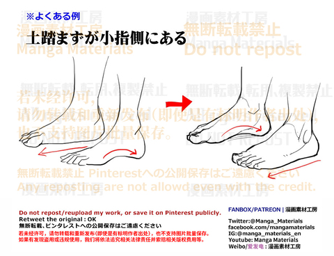 個人メモ：足のよくある違和感